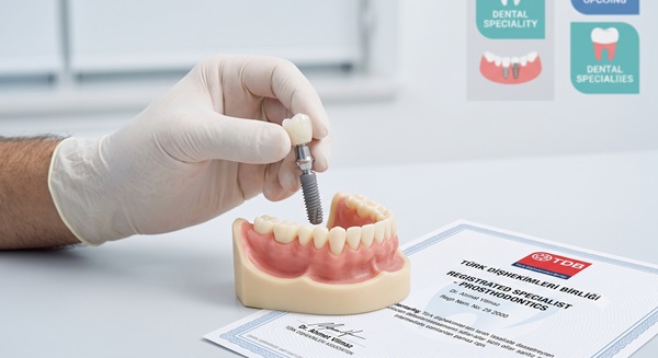 Close-up of TDB certified prosthodontist performing an advanced restorative dental procedure in Turkey