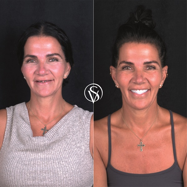 A radiant new chapter for Elizabeth at Vera Smile